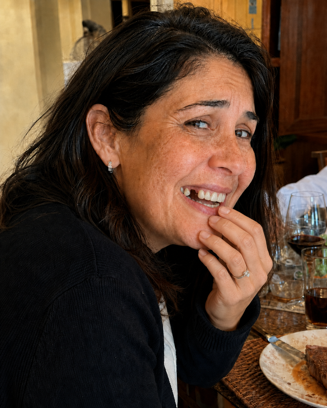 Laura, profesora de Padre las Casas, antes de recibir su implante dental en Temuco